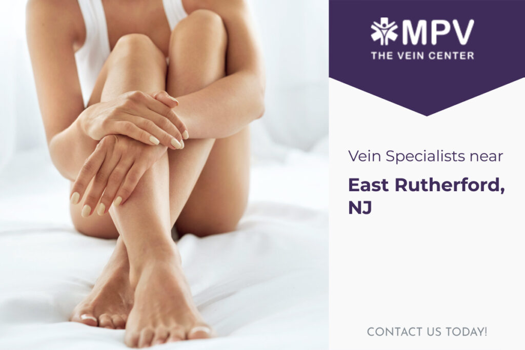 Vein Specialists near East Rutherford, NJ: Contact Us Today
