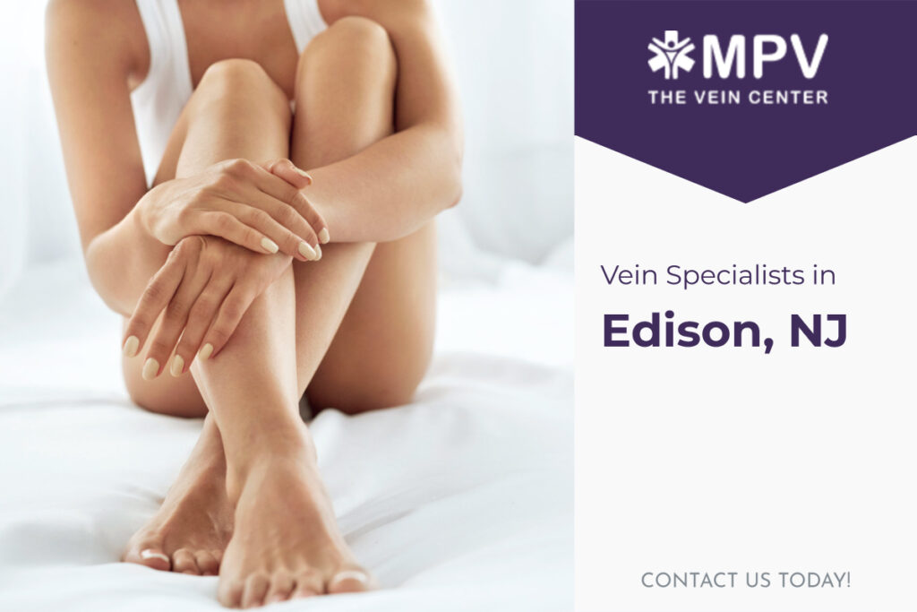 Vein Specialists in Edison, NJ: Contact Us Today