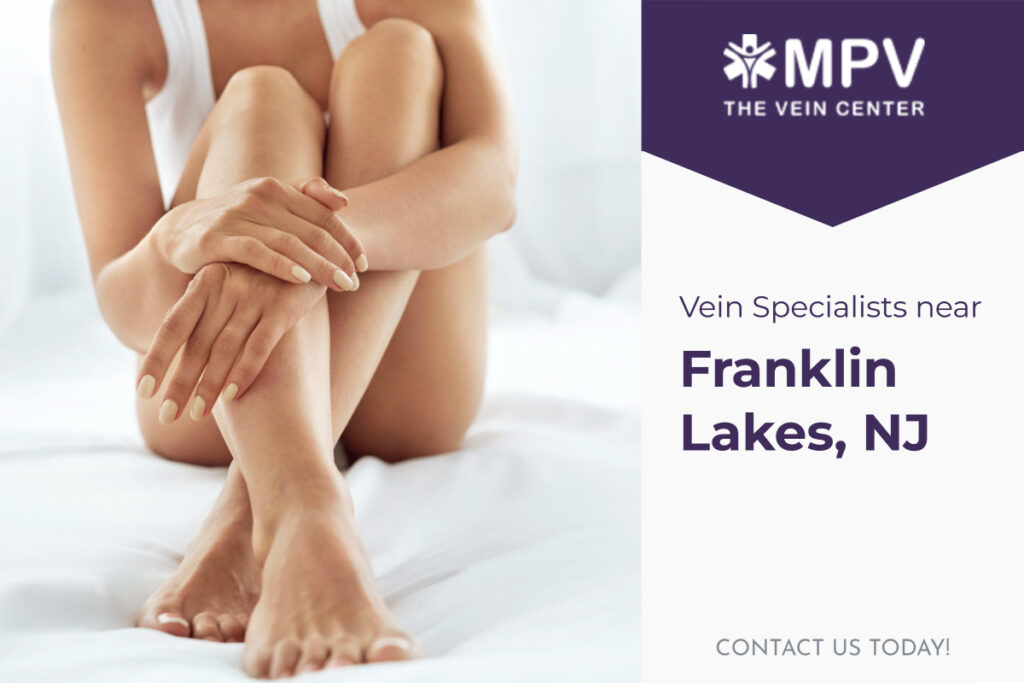 Vein Specialists near Franklin Lakes, NJ: Contact Us Today
