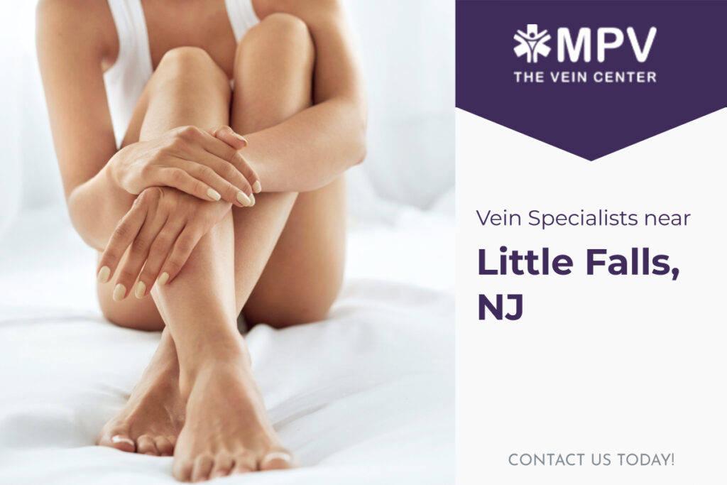 Vein Specialists near Little Falls, NJ Contact Us Today