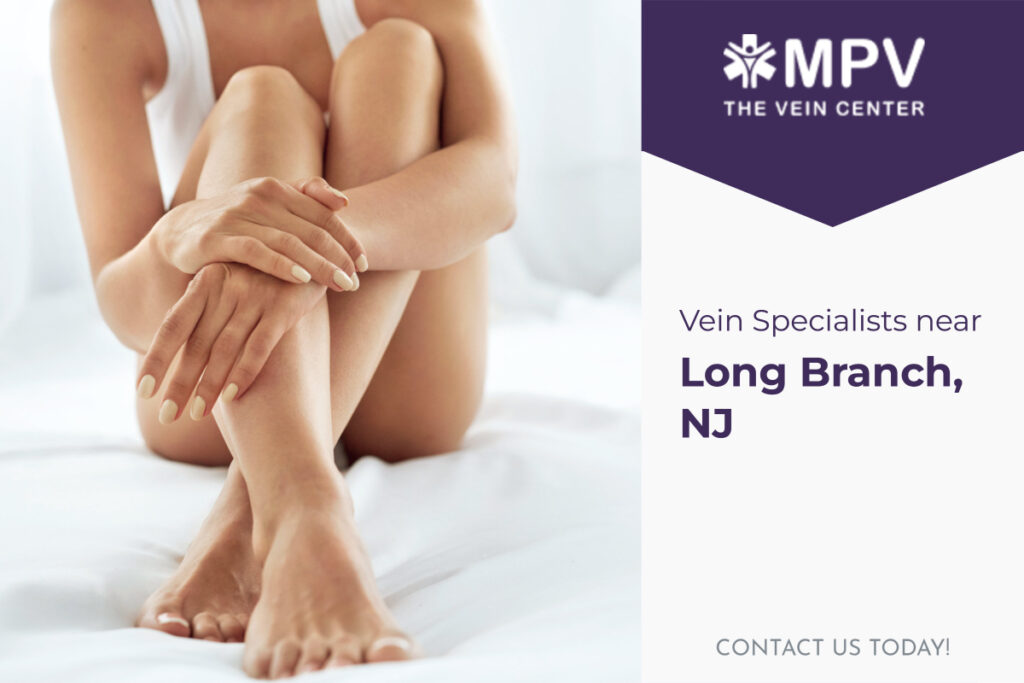 Vein Specialists near Long Branch, NJ: Contact Us Today