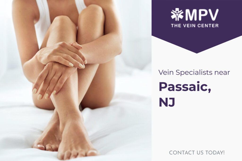 Vein Specialists near Passaic, NJ: Contact Us Today