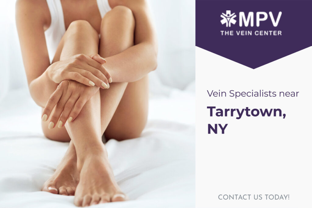 Vein Specialists near Tarrytown, NY: Contact Us Today