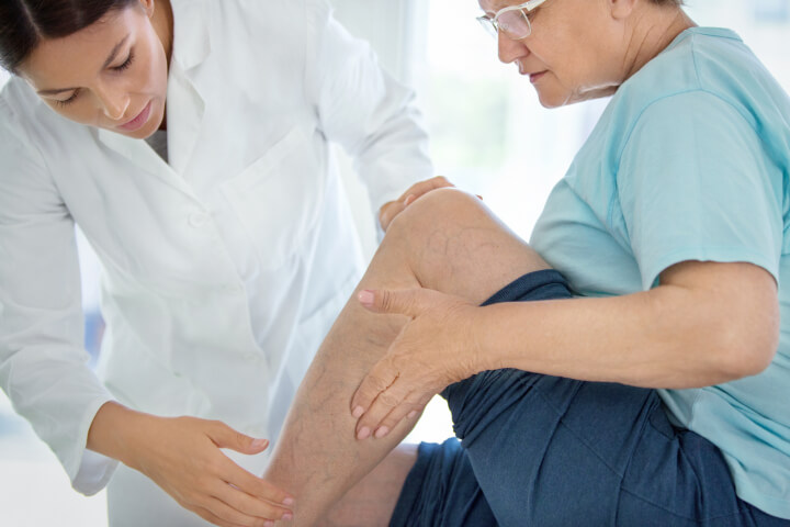 vein doctor and patient with varicose veins on inner thigh