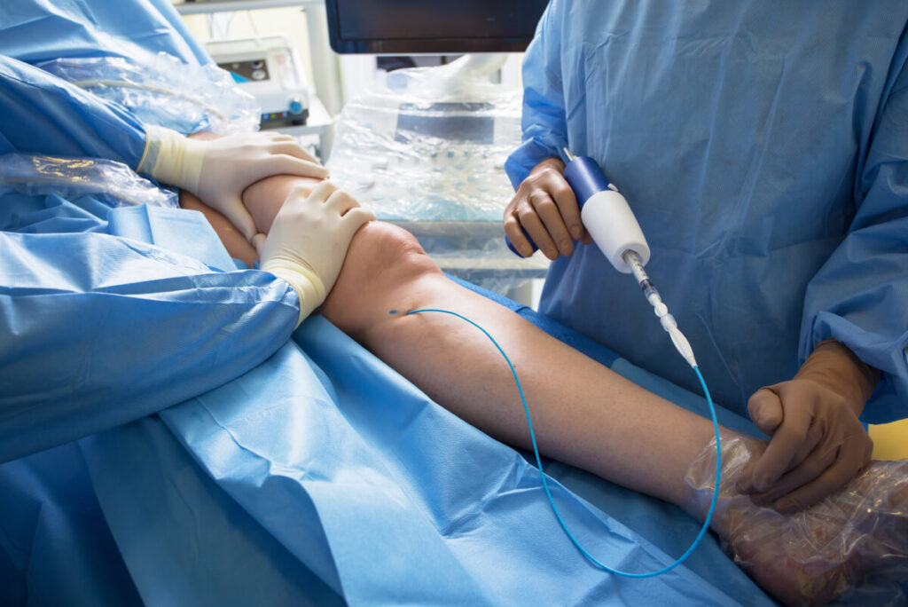 professional vein doctors doing surgery for varicose veins on a patient