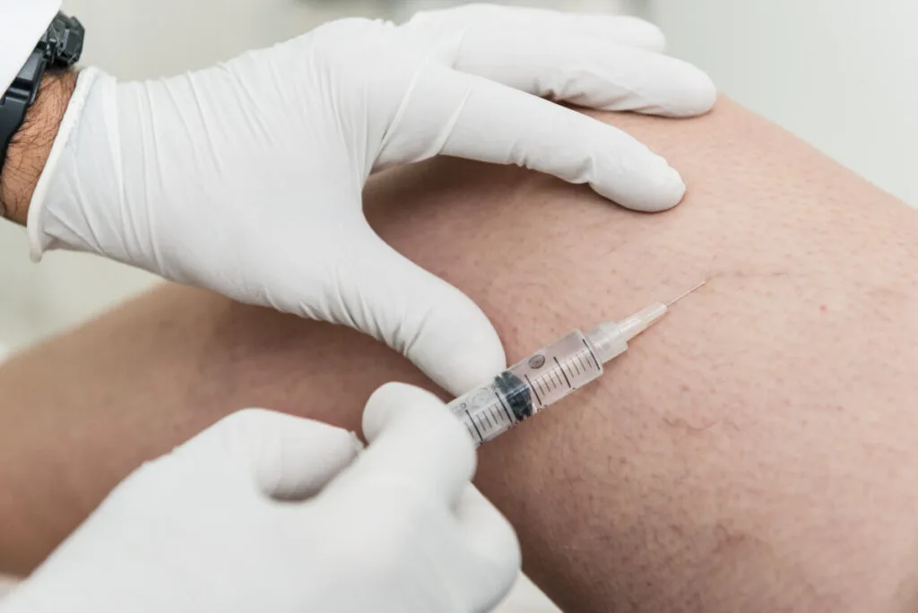 sclerotherapy treatment performed by professional vein doctor
