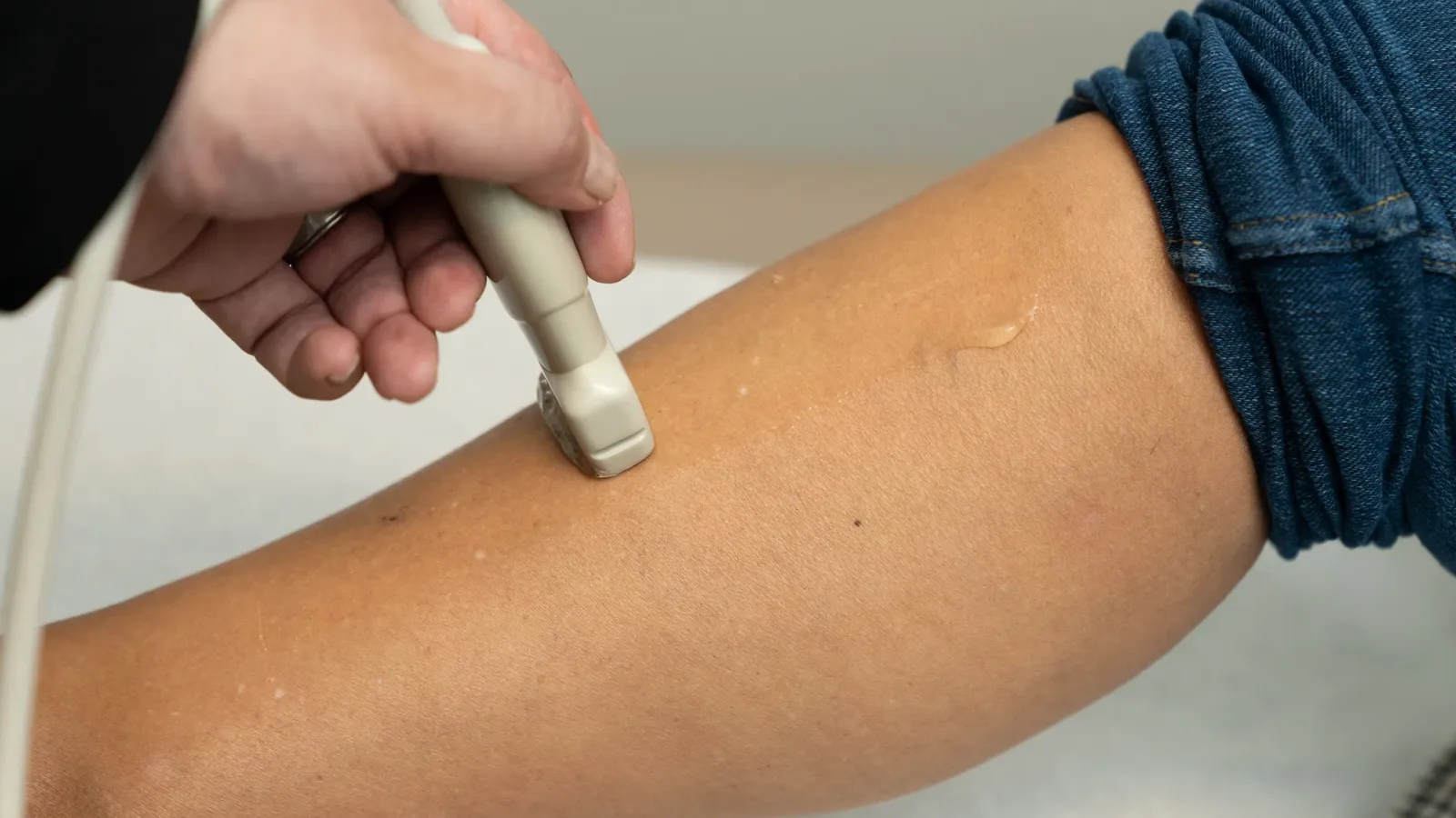 Medical-grade compression fitting at Vein Center Doctor