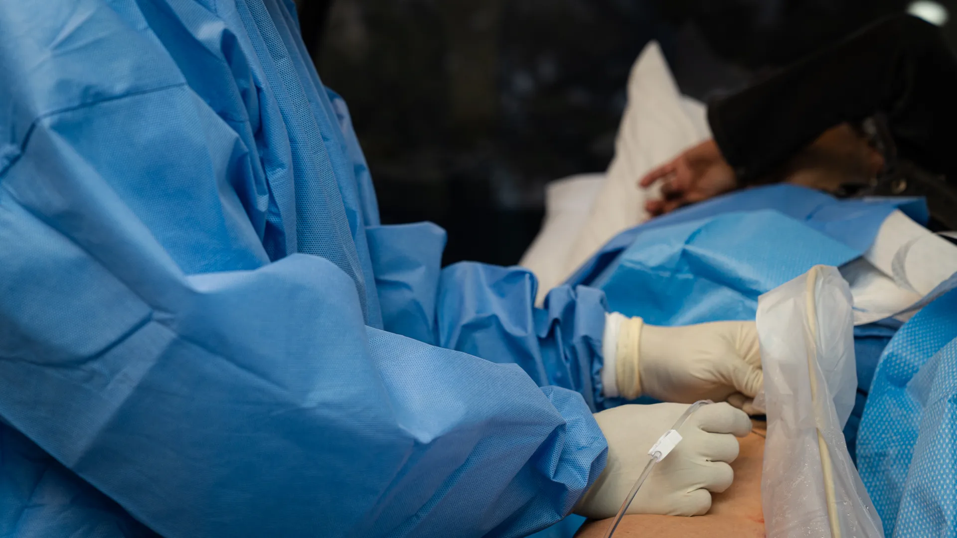 Radiofrequency Ablation
