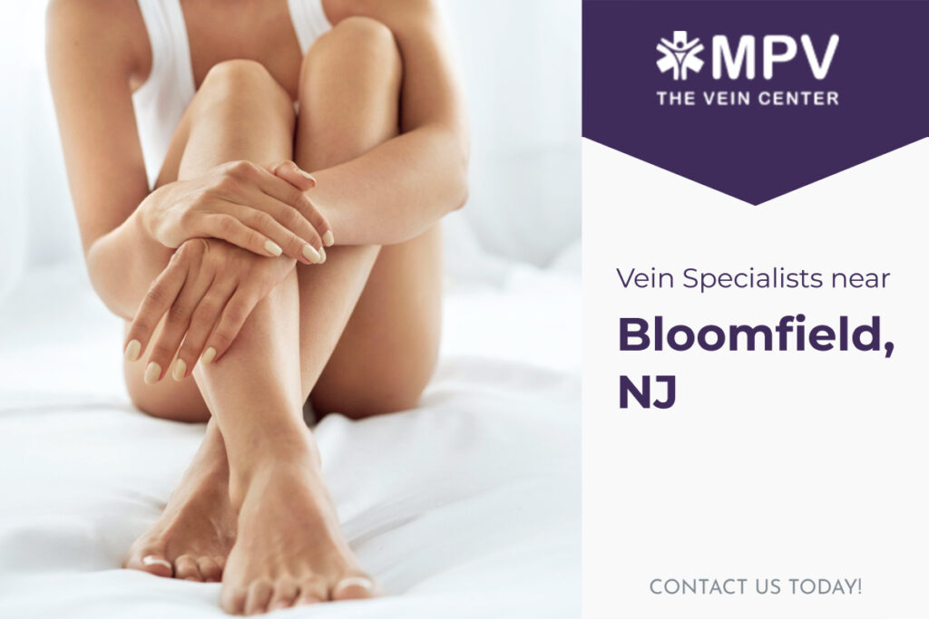Vein Specialists near Bloomfield, NJ: Contact Us Today
