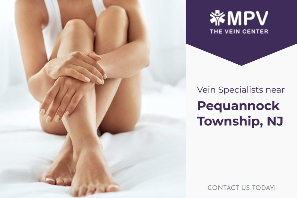Vein Specialists near Pequannock Township, NJ: Contact Us Today