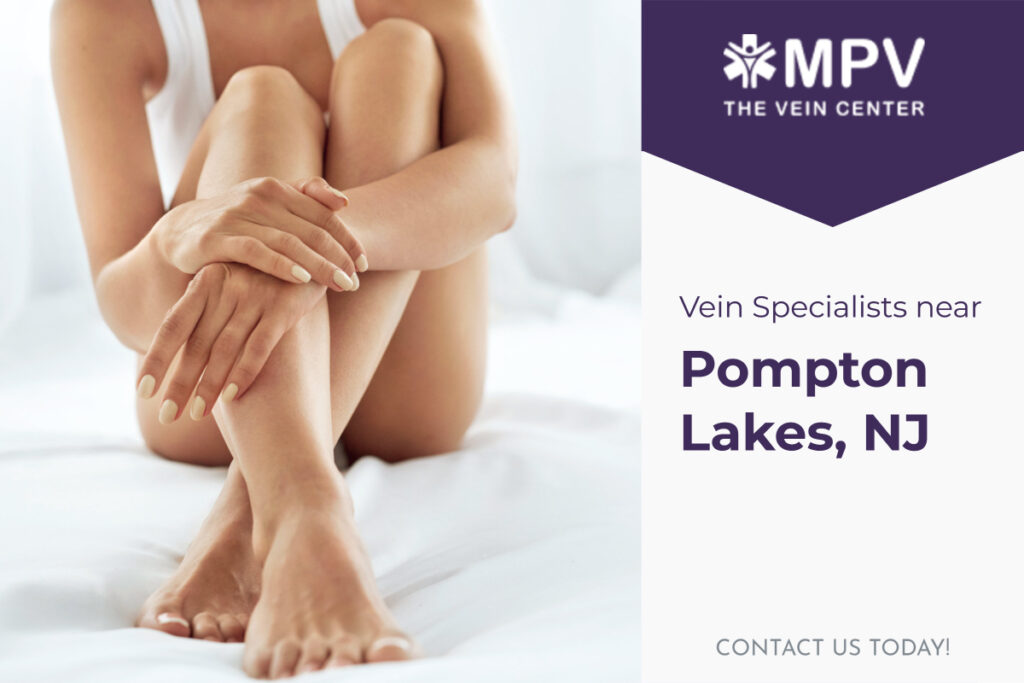 Vein Specialists near Pompton Lakes, NJ: Contact Us Today