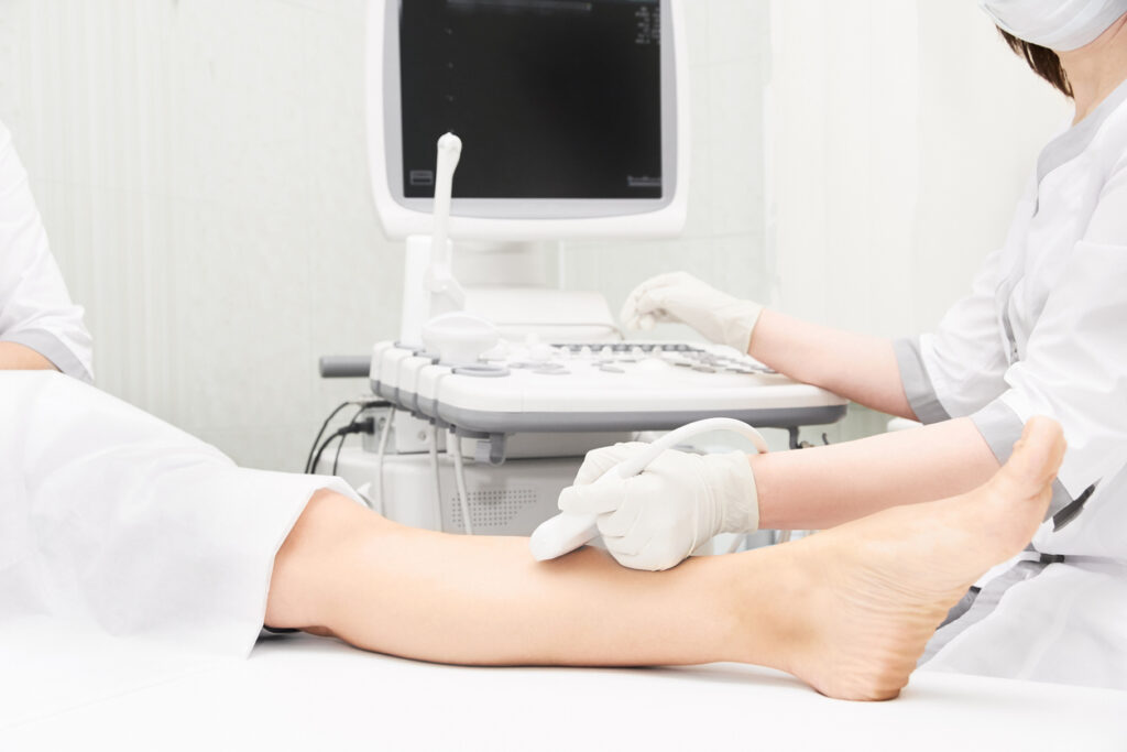 Scan medical equipment. Diagnosis ultrasound foot. Veins exam tool.
