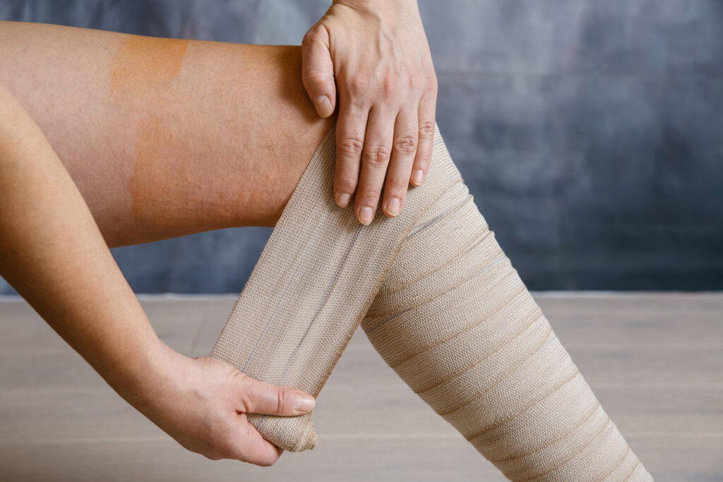 Woman patient with varicose veins applying elastic compression bandage